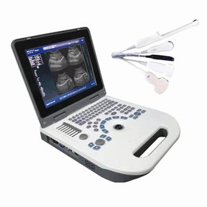 China ultrasound scanner price