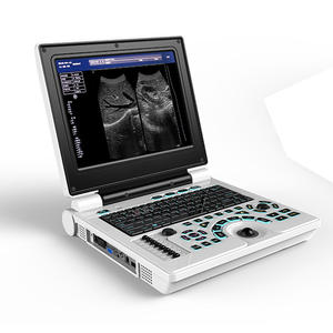 High quality portable ultrasound machine suppliers