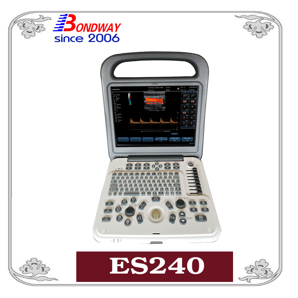 ES240 全数字彩色多谱勒超声系统