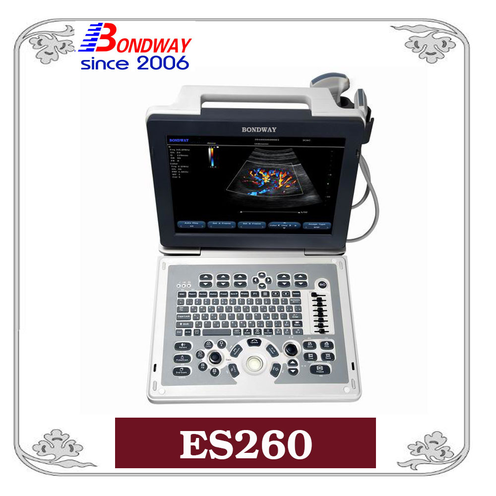 ES260 全数字彩色多谱勒超声系统