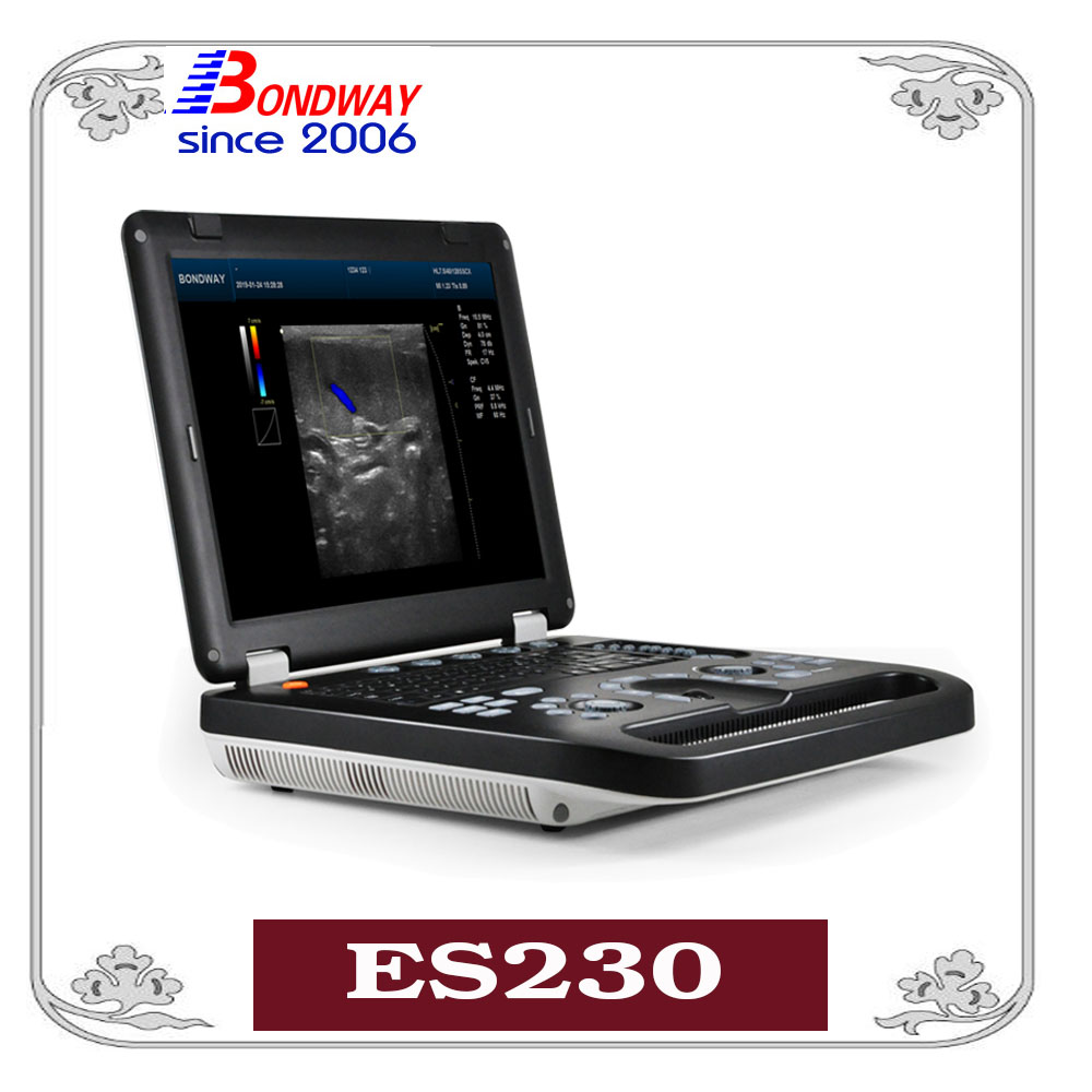 ES230 全数字4D彩色多谱勒超声系统