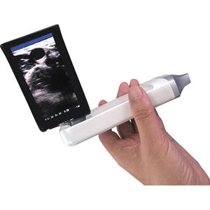 China wireless ultrasound scanner factory