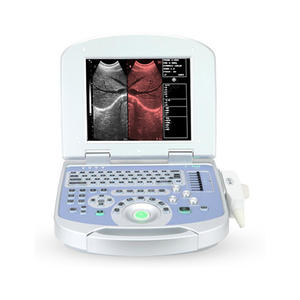 portable ultrasound machine manufacturers