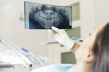 How to identify tooth decay on dental x-rays.