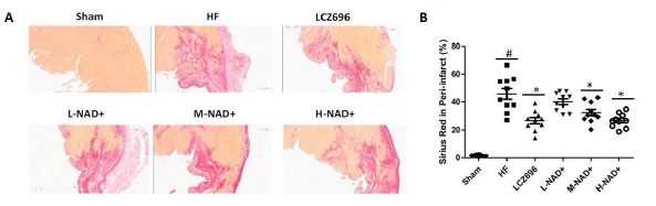Effects of NAD+ on cardiac fibrosis in peri-infarction in SD rats