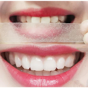 Achieve a Brighter Smile with Teeth Whitening Strips